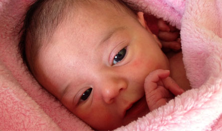 E.C.N.N.: L'examen clinique du nouveau-né (G)